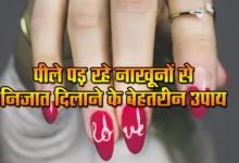 Yellow Nails Care Tips: Best ways to get rid of yellowing nails