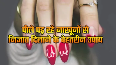 Yellow Nails Care Tips: Best ways to get rid of yellowing nails