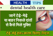 Teeth Care: Know how to get rid of crooked or protruding teeth