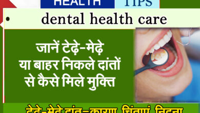 Teeth Care: Know how to get rid of crooked or protruding teeth